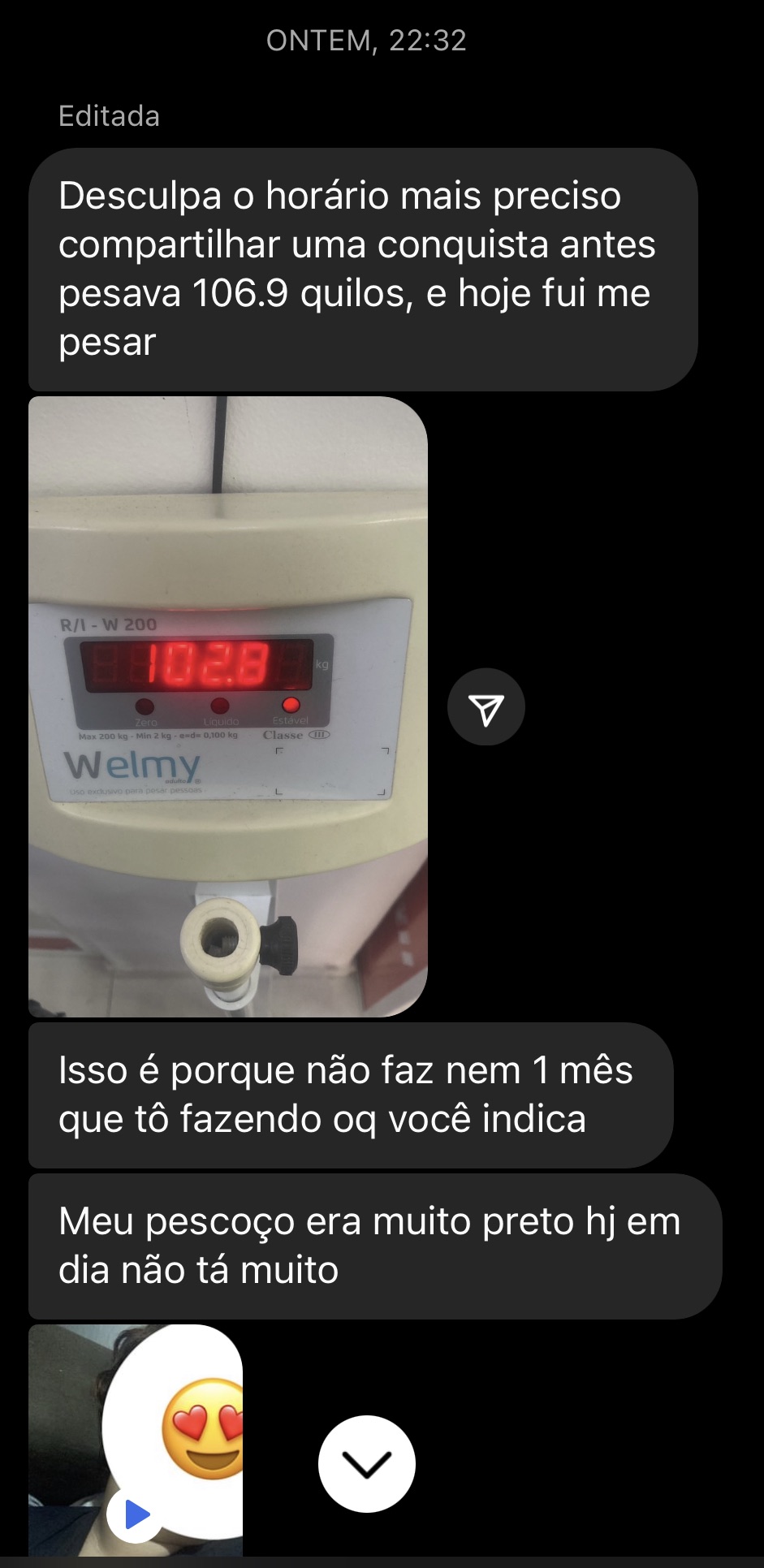 Mensagem de uma mulher com SOP: eliminou 4 kg em menos de um mês e o pescoço escuro clareou